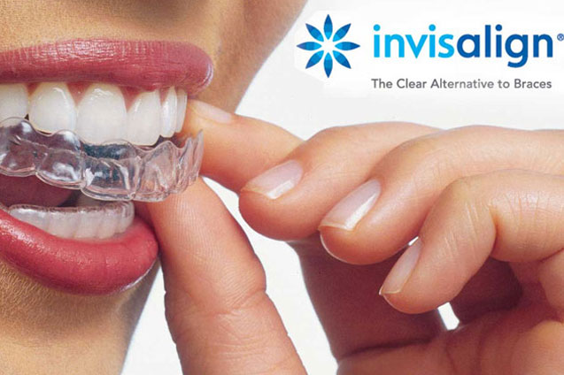 Straighten Teeth With Invisalign Braces - Smile Place Dental